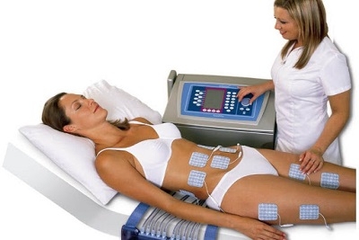 Elektrostimulacija mišića 10 tretmana 