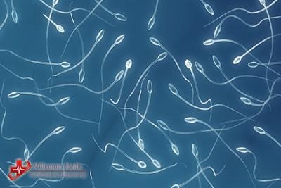Spermokultura i spermogram - analiza semene tečnosti