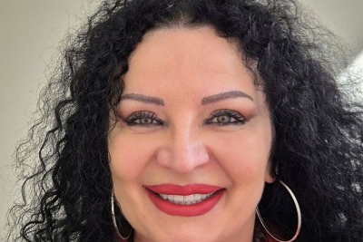  Kompozitne fasete slika 4