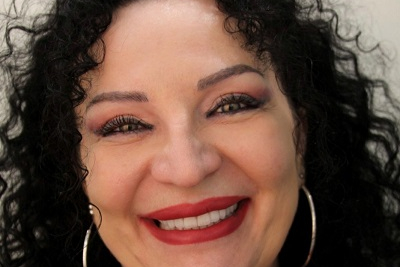  Kompozitne fasete slika 1