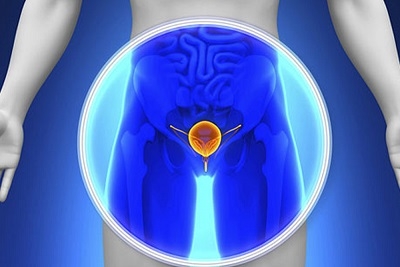 Tumor marker (PSA) za prostatu sa vađenjem krvi | Popust